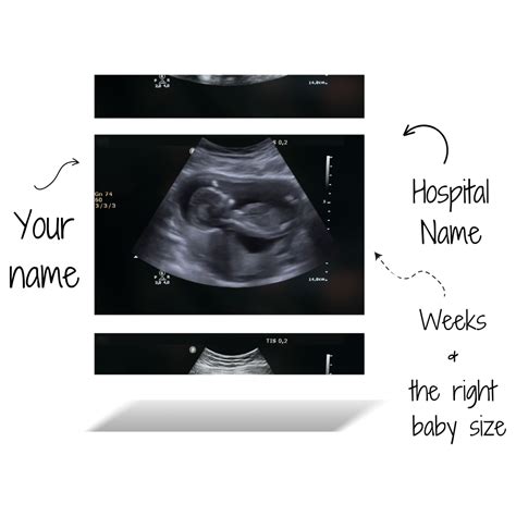 Fake Ultrasound With Name Freecareer Detail