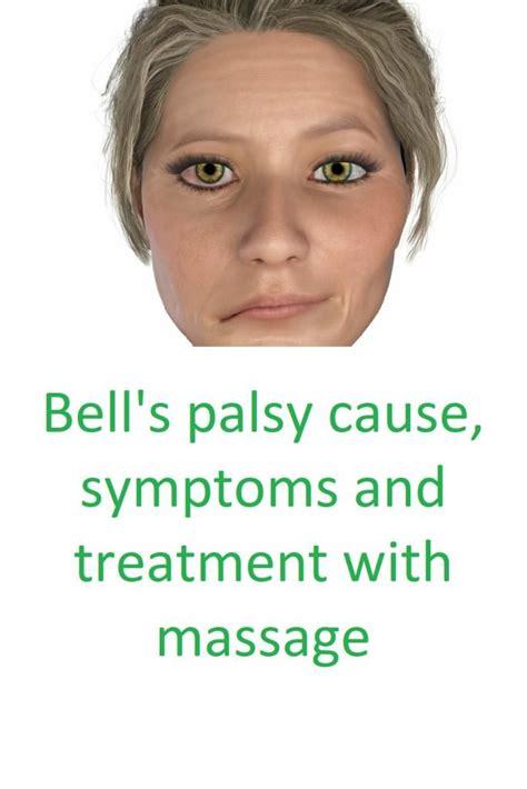 Bell S Palsy Cause Symptoms And Treatment With Massage