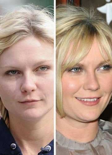 Look at these before and after pictures and draw your conclusions! Kirsten Dunst Plastic Surgery: Boob job, Teeth, Nose Job