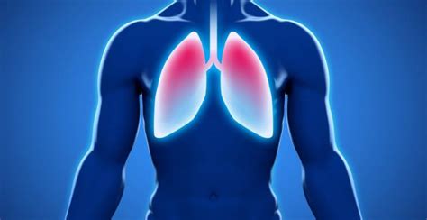 Lungenentz Ndung Ist Eine Entz Ndung Des Lungengewebes Bronchitis Lunge