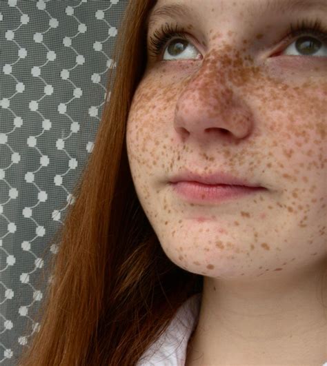 A Woman With Freckles On Her Face Looking At The Camera