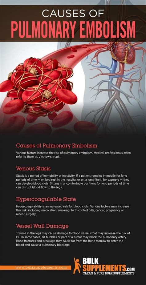Pulmonary Embolism Causes Symptoms And Treatment