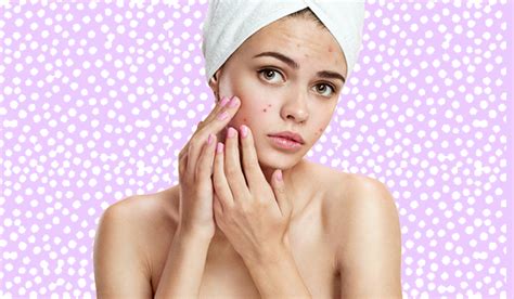 Sneaky Reasons That Cause Your Skin To Breakout