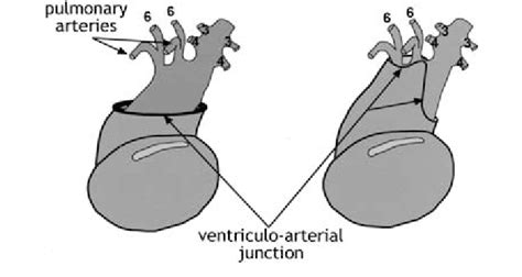 Diagram Depicting The Theory Of Ventricular Outflow And Great Vessels