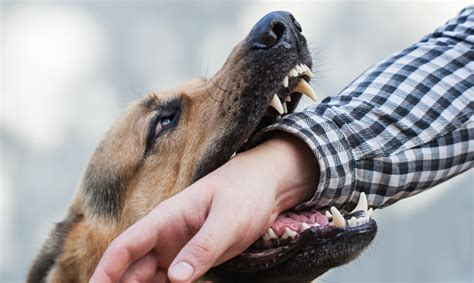 One German Shepherd Bites A Man By The Hand Training And Breeding