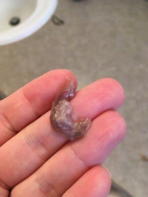 Some of you can also feel somewhat dizzy or during the 7th week of pregnancy, your body secretes the mucus plug, which structures at the opening of the cervical canal and seals off the uterus for. Mucus plug/bloody show? WARNING - gross photo - May 2017 ...