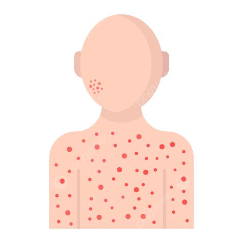 Itching Vector Itching Rash Itchy Skin Png And Vector With