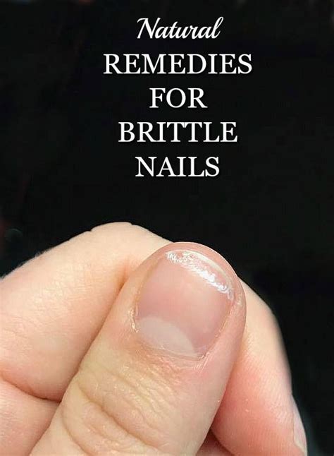 Learn How To Fix Brittle Nails Using 5 Natural Remedies Brittle Nail