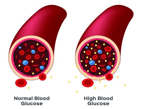 What is a normal blood sugar level? What are Normal HbA1c Levels and why is Lower Better ...