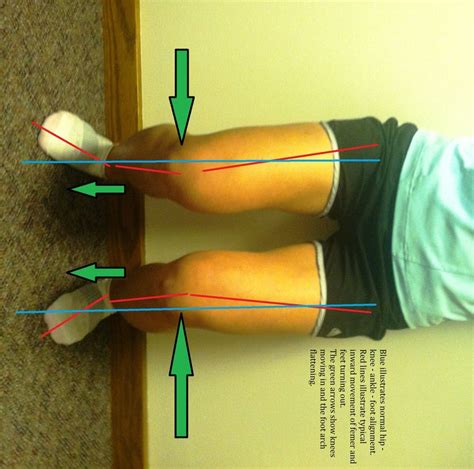 Shin Splints 101 Shin Splints Massage Therapy Fit Board Workouts