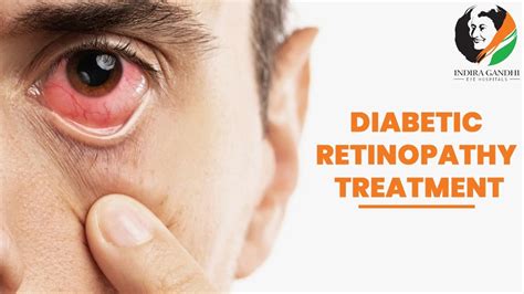 Diabetic Retinopathy Treatment Diabetic Retinopathy Symptoms