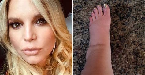 Jessica Simpson Gives Us A Hilarious Update On Her Post Pregnancy Feet
