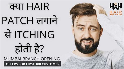 Mumbai Branch Opening क्या Hair Patch लगाने से Itching होती है