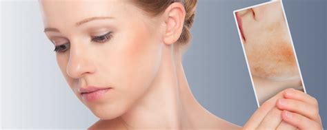 The Benefits Ipl Skin Rejuvenation Aesthetics Waxing Physio Rmt