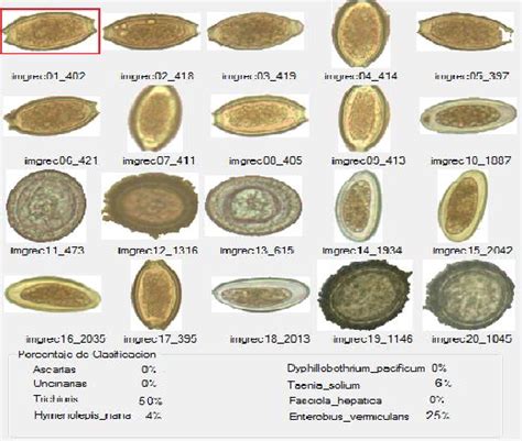 Human Parasite Egg Identification Chart