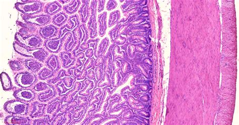 Human Ileum Cross Section Histology Slides 7 µm Sec Hande Stain Human
