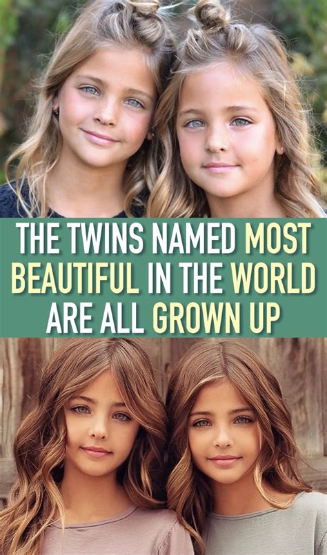 The Twins Named Most Beautiful In The World Are All Grown Up Twin