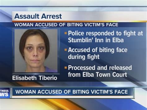 Woman Allegedly Bit Victims Face During Fight