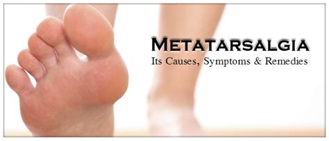 Metatarsalgia Causes Symptoms And Remedies Uk