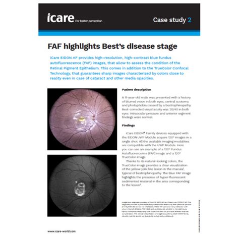 Icare Eidon Fa Fluorescein Angiography Confocal Fundus Imaging System