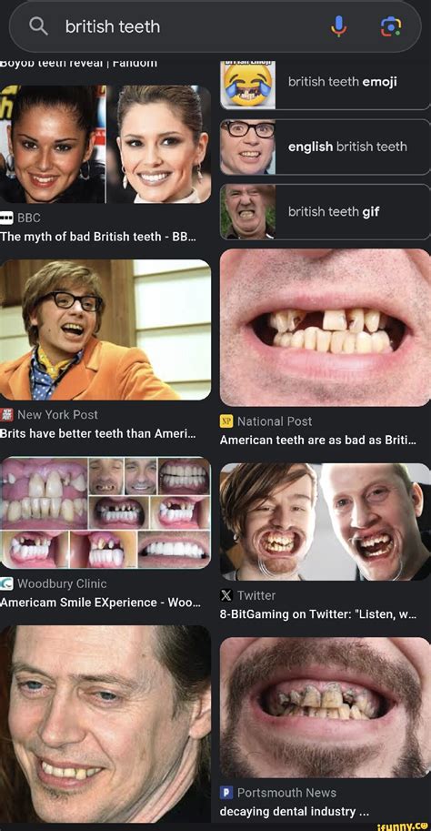 Q British Teeth Doyud Revedl I Bbc The Myth Of Bad British Teeth Bb