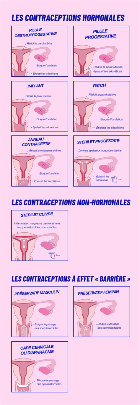Comment Marche La Contraception Explications Simples