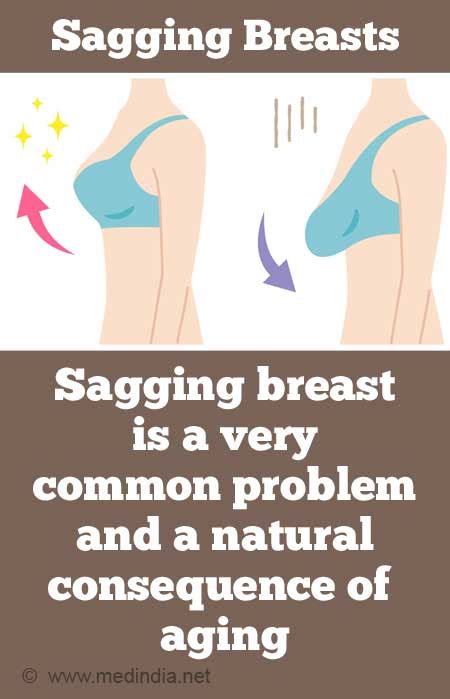 How To Avoid Breast Sagging Impactbelief