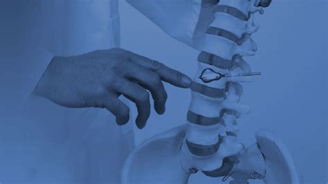 What Is A Kyphoplasty Procedure South Florida Spine Surgeon