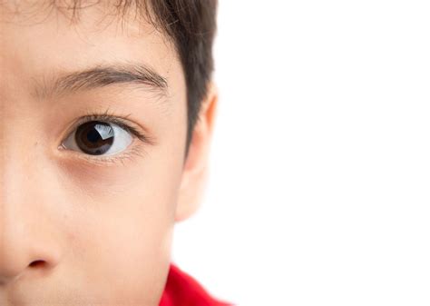Pink Eye Symptoms In Children