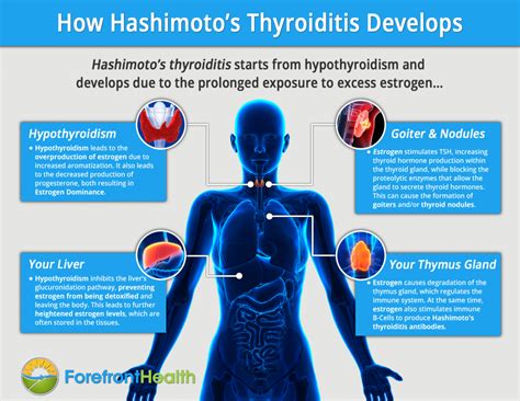 Hashimotos Thyroiditis How It Develops And How To Reverse It