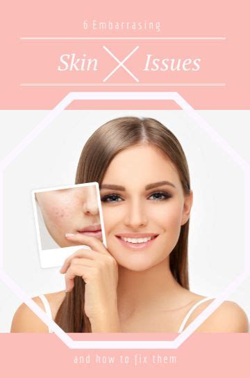 6 Embarrassing Skin Issues And How To Fix Them Beauty Personal Care