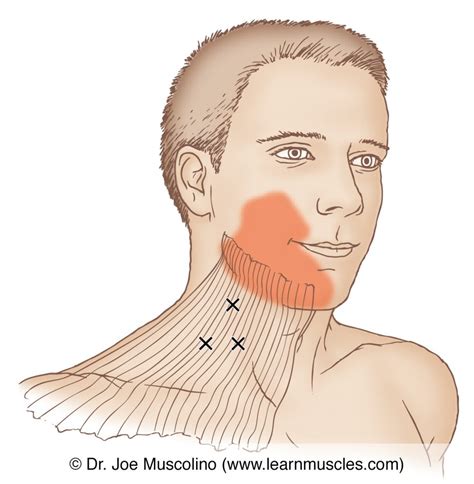 Platysma Trigger Points Learn Muscles