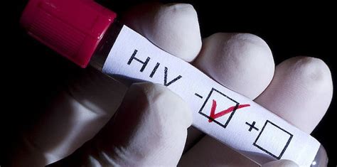 What Happens During A Hiv Test