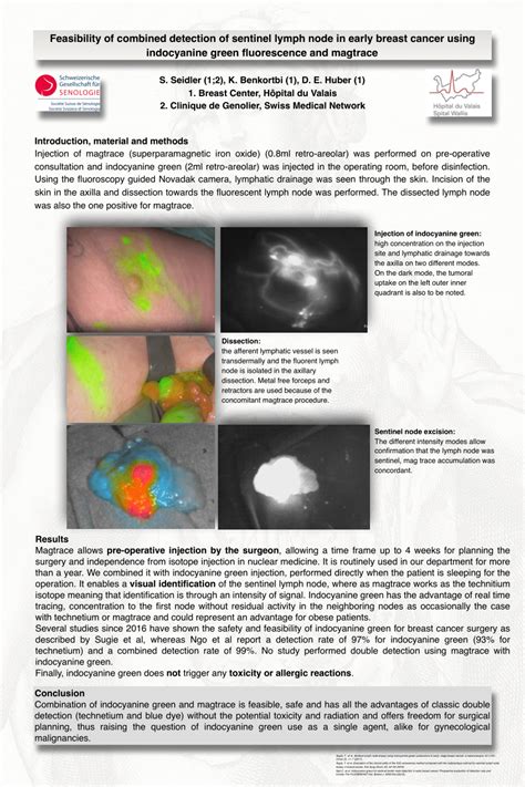 Pdf Feasibility Of Combined Detection Of Sentinel Lymph Node In Early