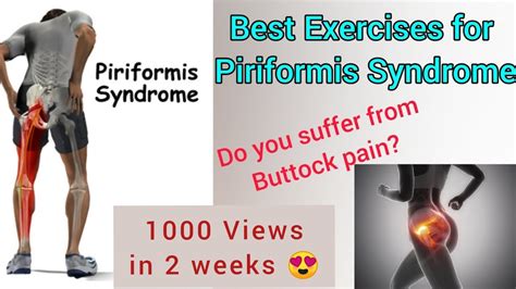 5 Best Exercises For Piriformis Syndrome Youtube