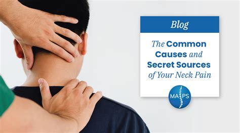 Maps The Common Causes And Secret Sources Of Your Neck Pain