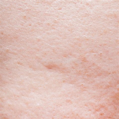 Human Face Skin Texture Stock Photo Image Of Dermatology 76786870