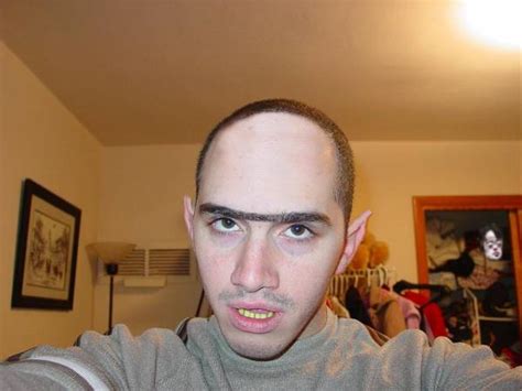 I was asking can i get a hair transplant and does have a side effect would doctor agree to make a hair transplant on tease places on the pictures. Offical Bad Hairline Thread | HYPEBEAST Forums