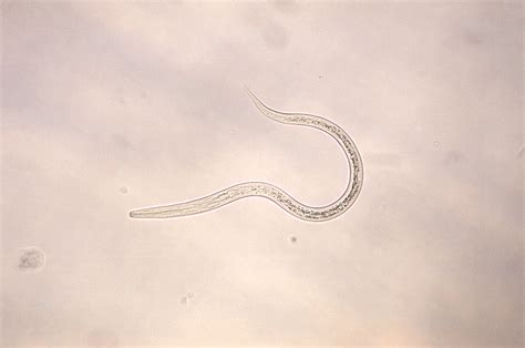 Public Domain Picture Hookworm Filariform Larva Id 13523566812662