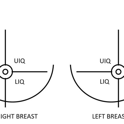 Quadrant Wise Segmentation Of Breasts Upper Outer Uoq Upper Inner Download Scientific