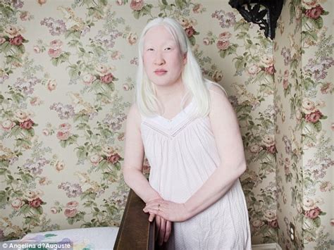 Angelina DAuguste S Photo Series Features People With Albinism Daily