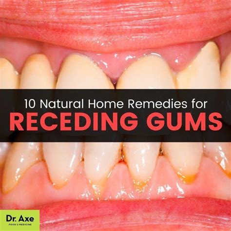 Pin On Healthy Gum Tips