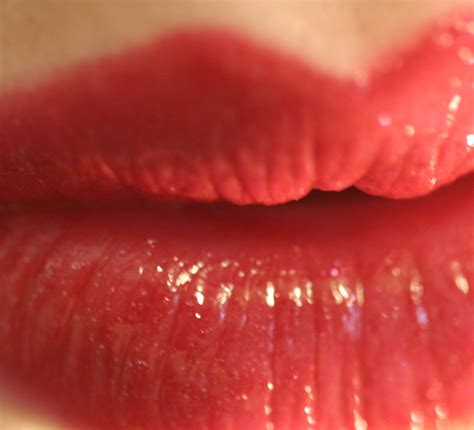 read my lips no more pout problems castleknock cosmetic clinic