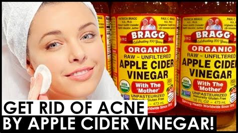 How To Use Apple Cider Vinegar For Acne 😍 How To Get Rid Of Acne Scars