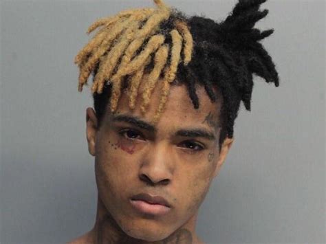 How Did Xxxtentacion Pull His Dreads Up At The Backside Rxxxtentacion