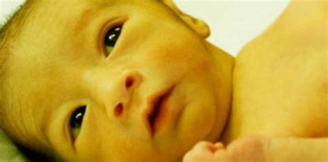Newborn Jaundice And Breastfeeding What You Need To Know