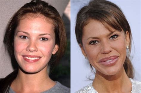 The 20 Most Shocking Celebrity Plastic Surgery Disasters Of All Time 4