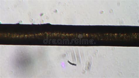 Human Hair Under A Microscope Stock Footage Video Of Single Sample