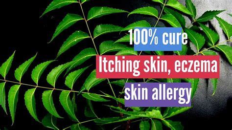 Here are the indian home remedies for skin allergies. Itching skin, Eczema, skin allergy Best Home Remedy - Neem ...