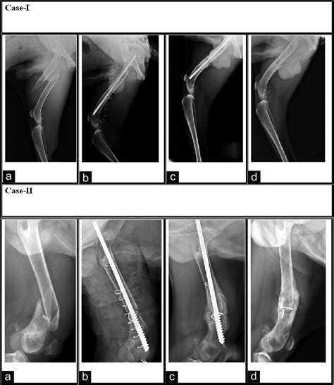 Serial Radiographic Observations In Group Ii Positive Profile Pin In